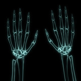 X-ray left and right hands