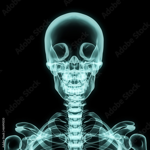 X-ray upper chest included skull