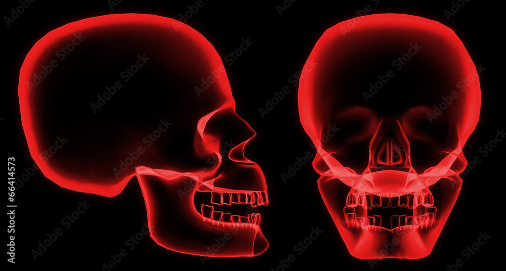 X-ray skull X-ray skull