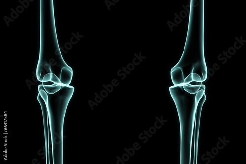 X-ray left and right knee