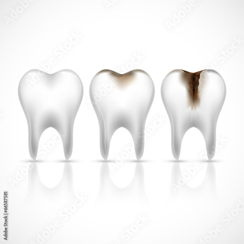 Teeth realistic set