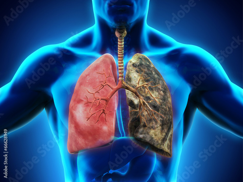 Obraz na płótnie Healthy Lung and Smokers Lung