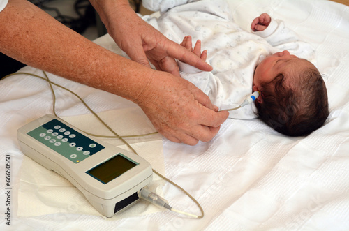 Obraz na płótnie Newborn Infant Hearing Screening