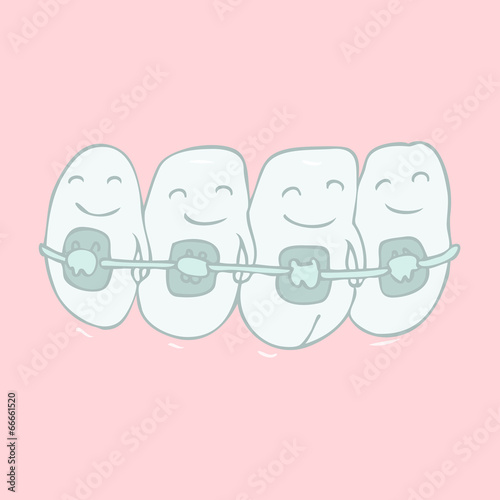 orthodontic treatment (tooth braces) vector illustration