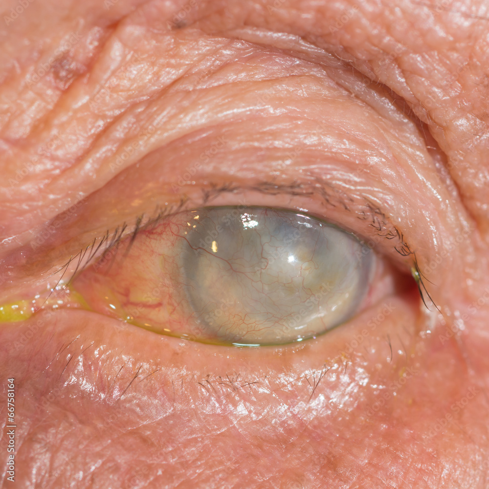 Fototapeta premium Eye exam
