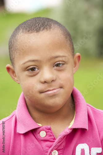 9 year old boy with Downs Syndrome