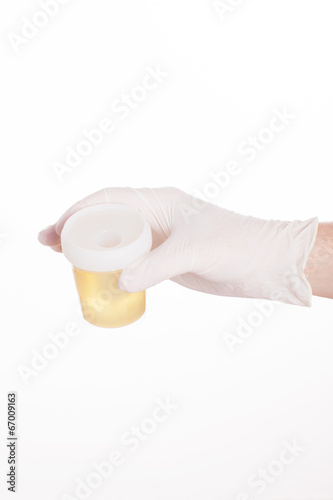 urinalysis