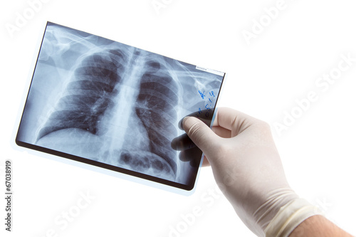 Male hand in medical glove holding lung radiography