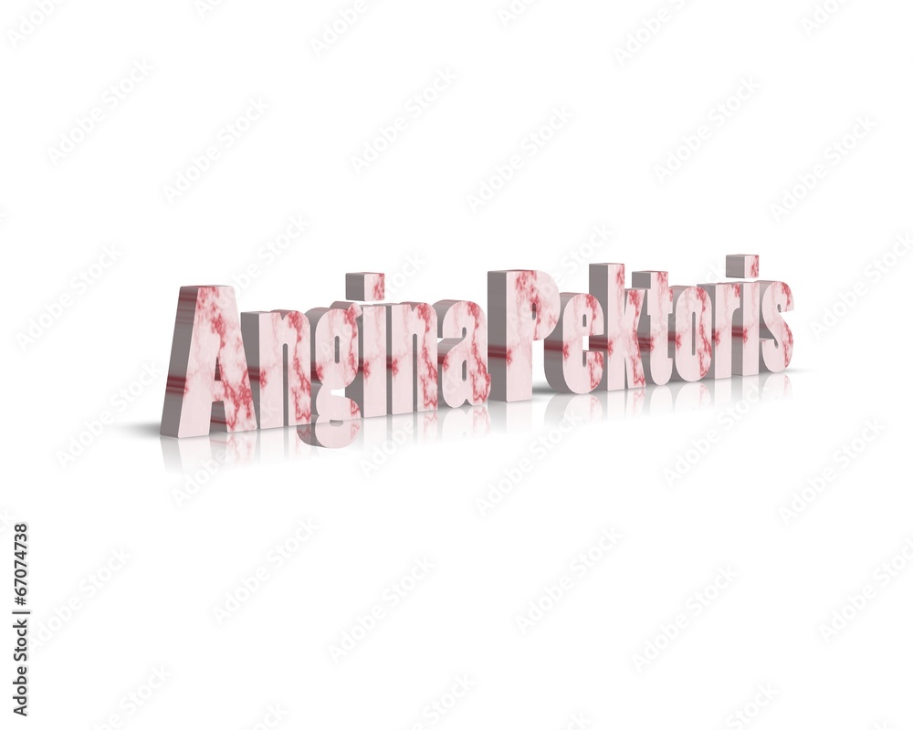 angina pektoris