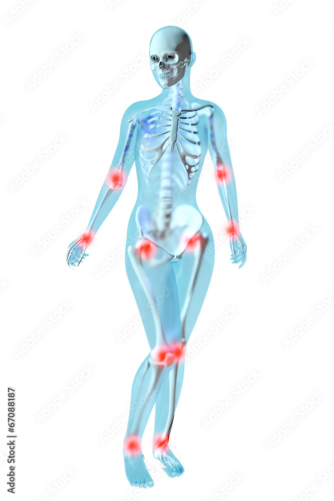 Weibliche Anatomie - Gelenkschmerzen