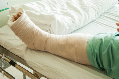 woman wearing a leg brace, Broken leg