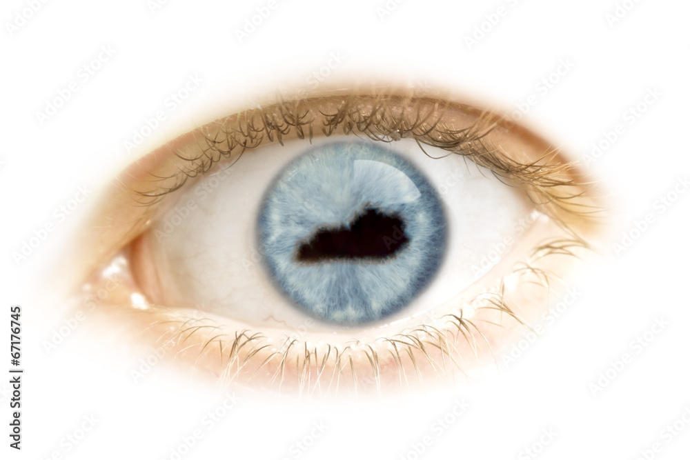 Close-up of an eye with the pupil in the shape of Kentucky.(seri Close-up of an eye with the pupil in the shape of Kentucky.(seri