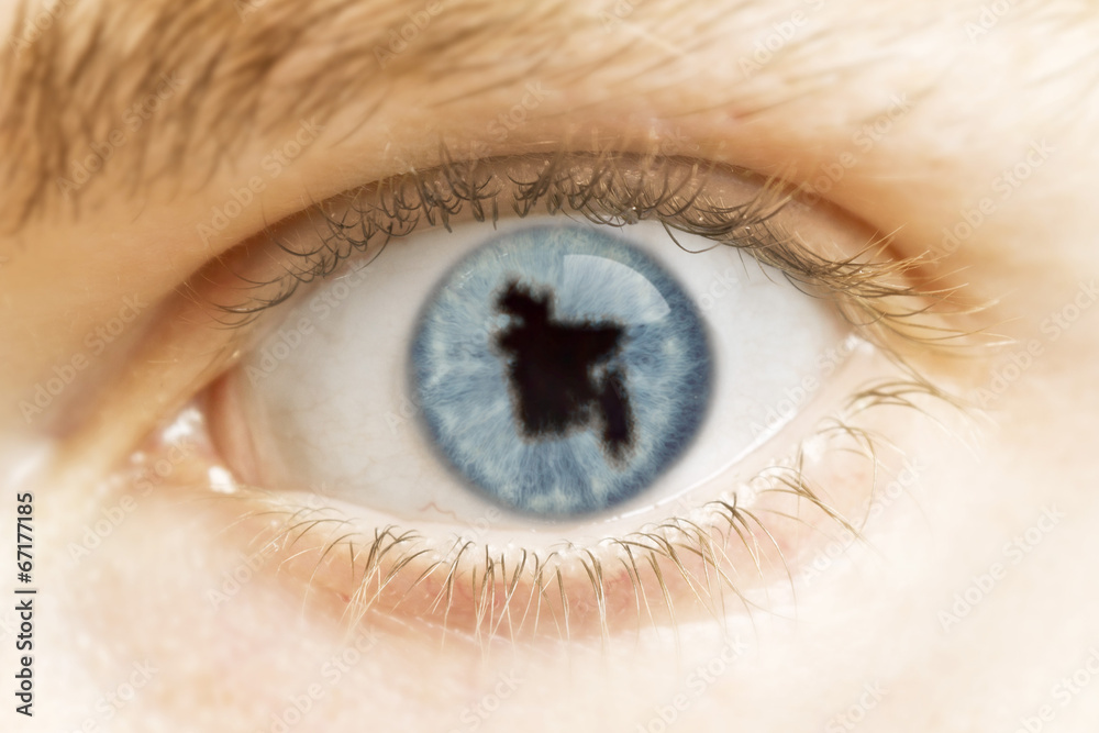 Close-up of an eye with the pupil in the shape of Bangladesh.(se Close-up of an eye with the pupil in the shape of Bangladesh.(se