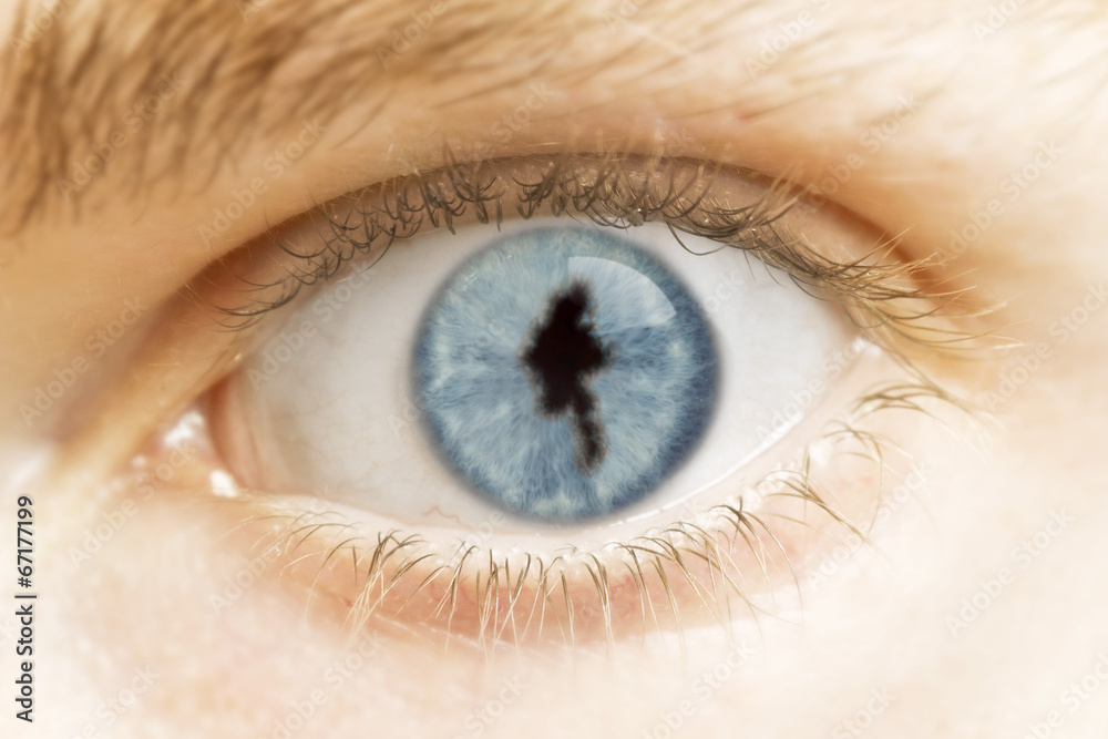 Close-up of an eye with the pupil in the shape of Burma.(series) Close-up of an eye with the pupil in the shape of Burma.(series)