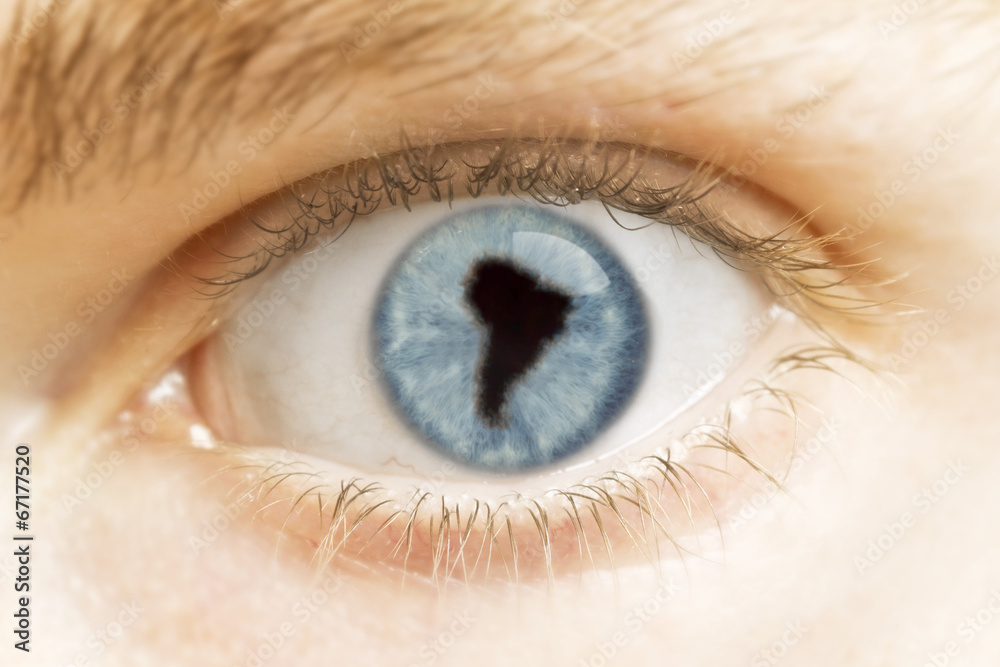 Close-up of an eye with the pupil in the shape of South America. Close-up of an eye with the pupil in the shape of South America.