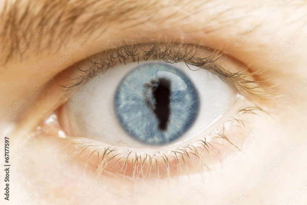 Close-up of an eye with the pupil in the shape of Gibraltar.(ser Close-up of an eye with the pupil in the shape of Gibraltar.(ser