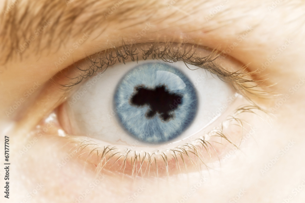 Close-up of an eye with the pupil in the shape of Ukraine.(serie Close-up of an eye with the pupil in the shape of Ukraine.(serie