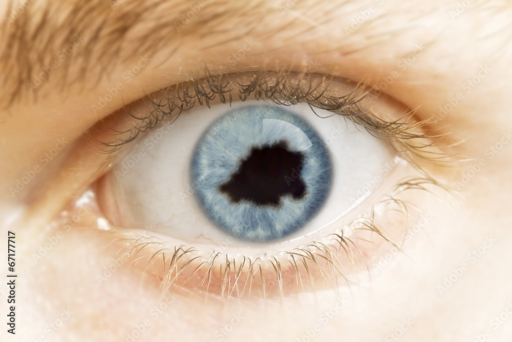 Close-up of an eye with the pupil in the shape of Vatican City.( Close-up of an eye with the pupil in the shape of Vatican City.(