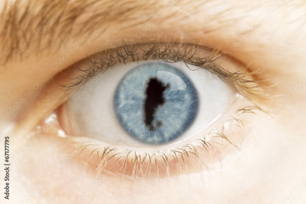 Close-up of an eye with the pupil in the shape of Argentina.(ser Close-up of an eye with the pupil in the shape of Argentina.(ser
