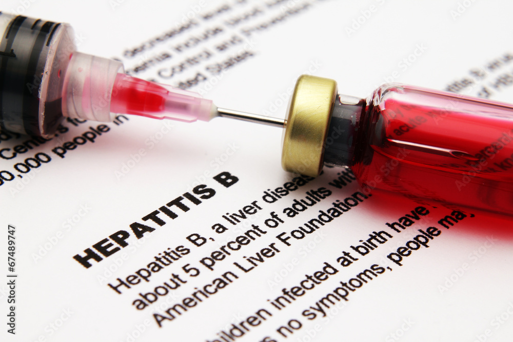 Hepatitis - obrazy, fototapety, plakaty 