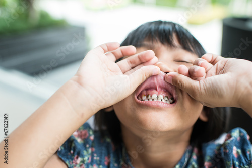 Asian girl showing her teeth.