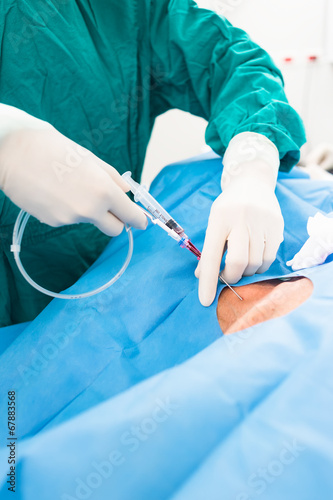 central venous pressure procedure
