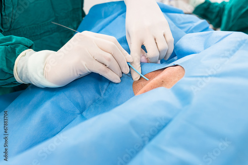 central venous pressure procedure