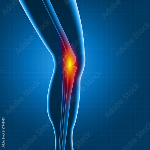 Knee pain
