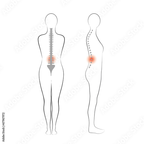 Vector woman body shape. Vertebrae pain.