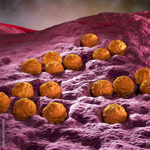 Rubella - German measles