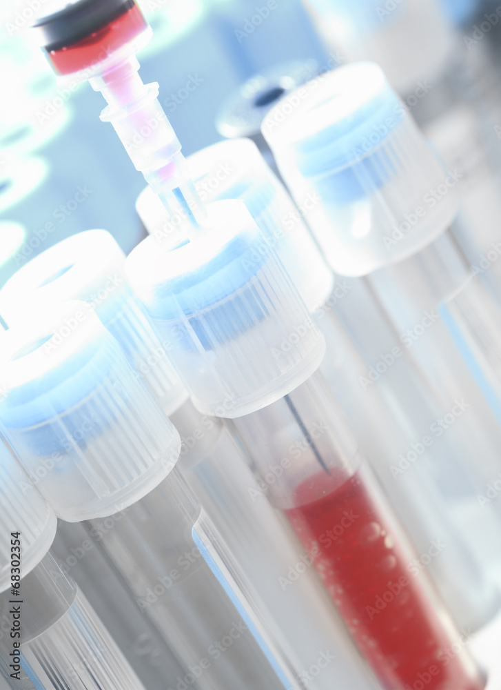 Tubes and the syringe with the blood Tubes and the syringe with the blood