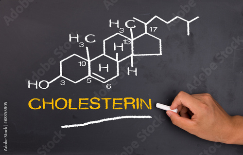 chemical formula of cholesterol