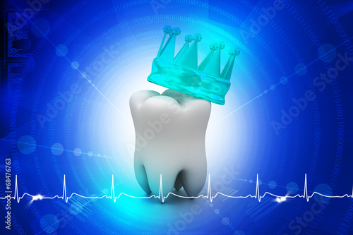 tooth In Golden Crown