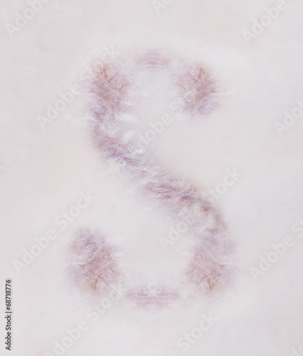 Scar letter S on human skin