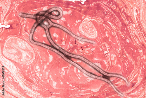 Ebola virus