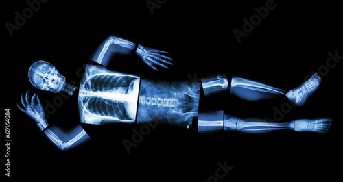 X-ray whole human's body (sleeping)