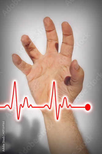 Hand expressing heart attack - Medical concept