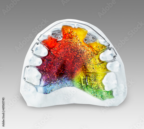 Multicolored and glittered orthodontic appliance for a child photo