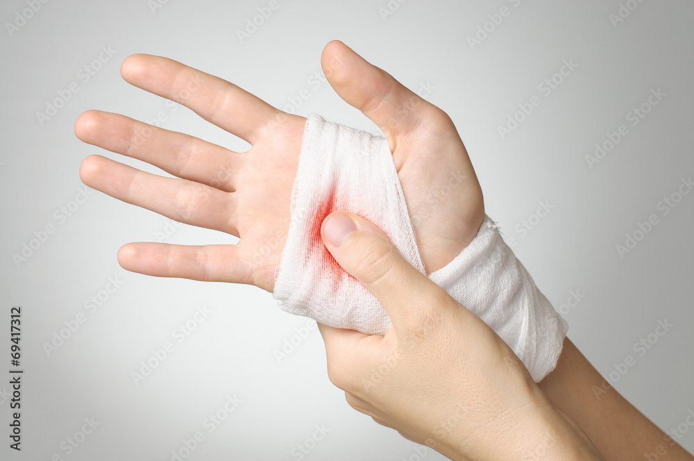 Injured hand with bloody bandage Photos | Adobe Stock