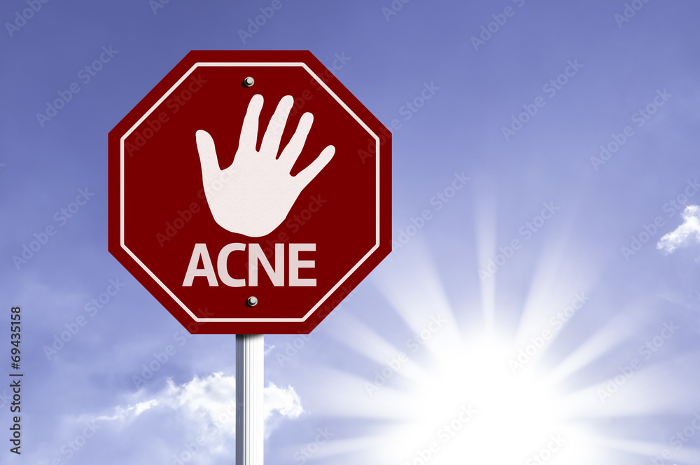 Stop Acne red sign with sun background Stop Acne red sign with sun background