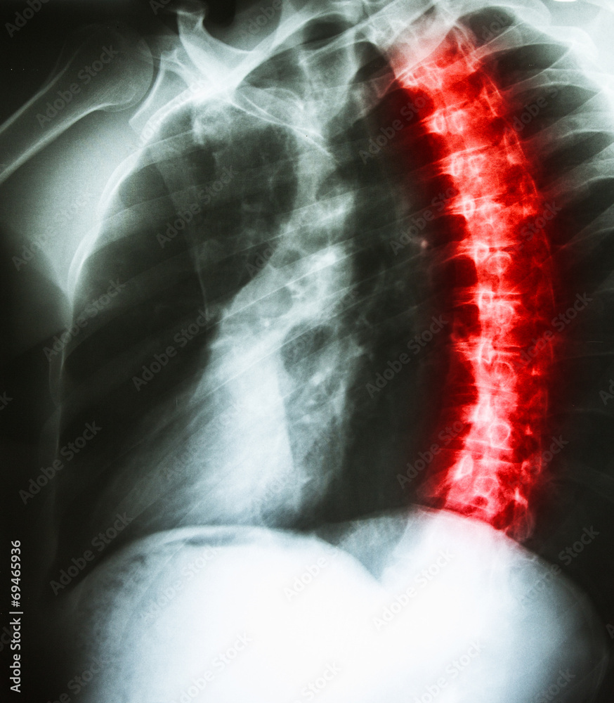 X-Ray scan human X-Ray scan human