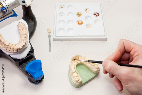 Making Facial Dental Prosthetic.