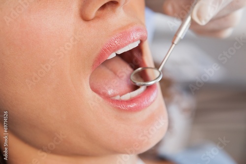 Dentist examining a patients teeth in the dentists chair