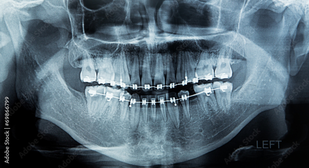 X-Ray scan human