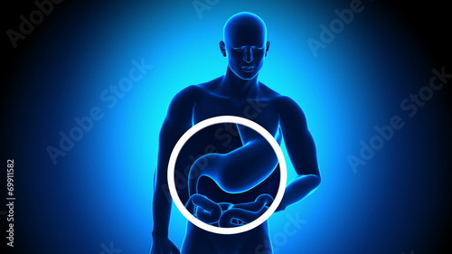 Stomach Pain - Gastric Acid - Reflux