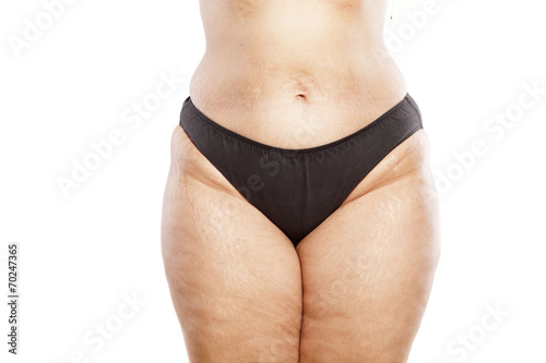 hips of a very thick woman in black panties