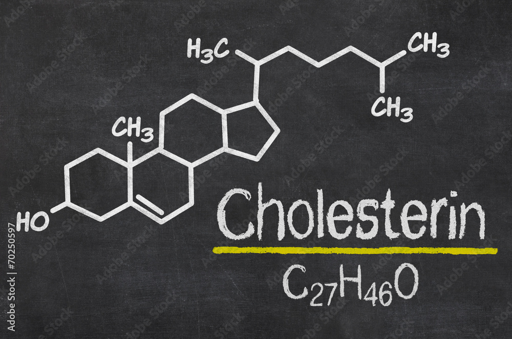 Schiefertafel mit der chemischen Formel von Cholesterin Schiefertafel mit der chemischen Formel von Cholesterin