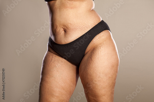 Photos hips of a very thick woman in black panties