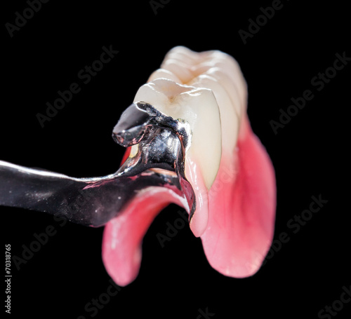 Removable dental prosthesis