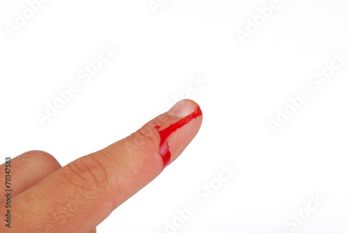 bloody finger